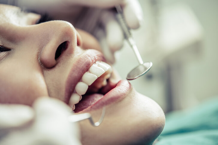 Odontoiatria conservativa otturazioni estetiche carie