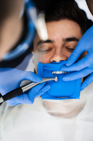 Endodonzia devitalizzazione dente