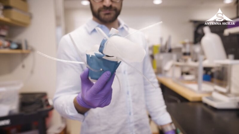 &Egrave; catanese il pap&agrave; del cuore in 3D