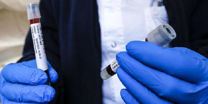 Sicilia: incidenza torna su, ma gli ospedali reggono