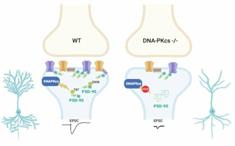 Alzheimer, passo avanti per la diagnosi precoce