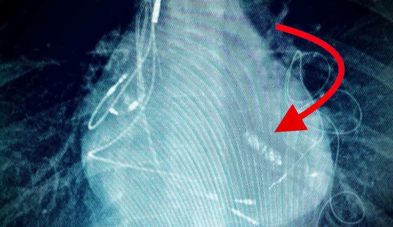 A Taormina un'operazione mai vista A Taormina un'operazione mai vista