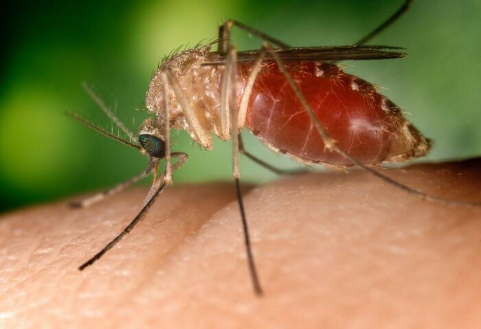 Caso West Nile: paziente in terapia intensiva