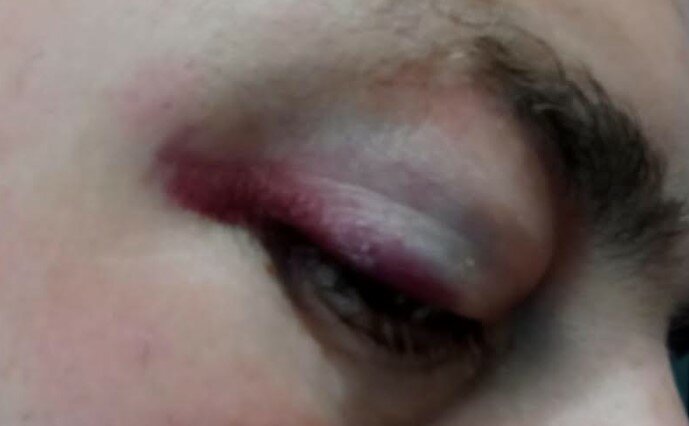 Alt, controllo: pugno in un occhio al carabiniere