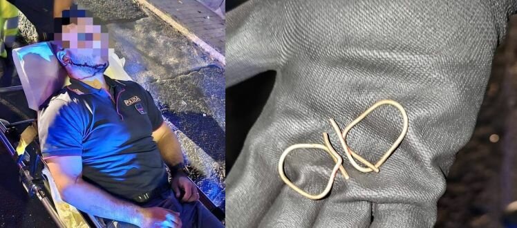 A Catania 2 agenti feriti: 'Assaliti con tirapugni'