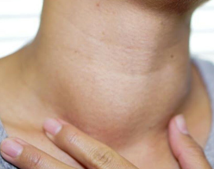 In Sicilia un piano per il controllo dello iodio nel sale