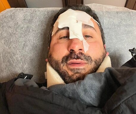 Supera prova del cuoco, non le buche di Palermo