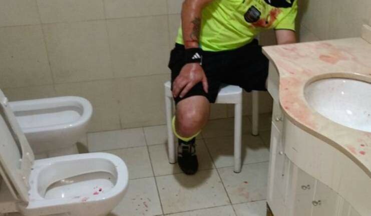 Mascalucia, botte all'arbitro