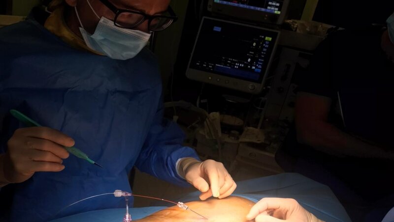 Agrigento, neurostimolazione dopo il fuoco di Sant&rsquo;Antonio