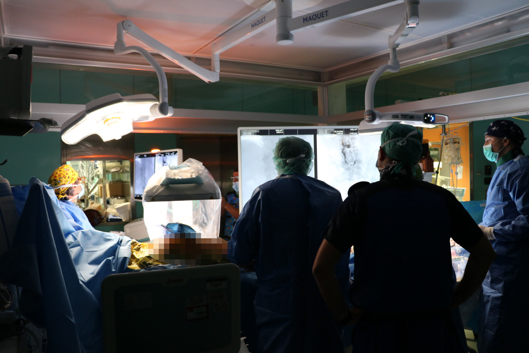 Al Cannizzaro l'angiografo più evoluto supportato dall'IA Al Cannizzaro l'angiografo più evoluto supportato dall'IA