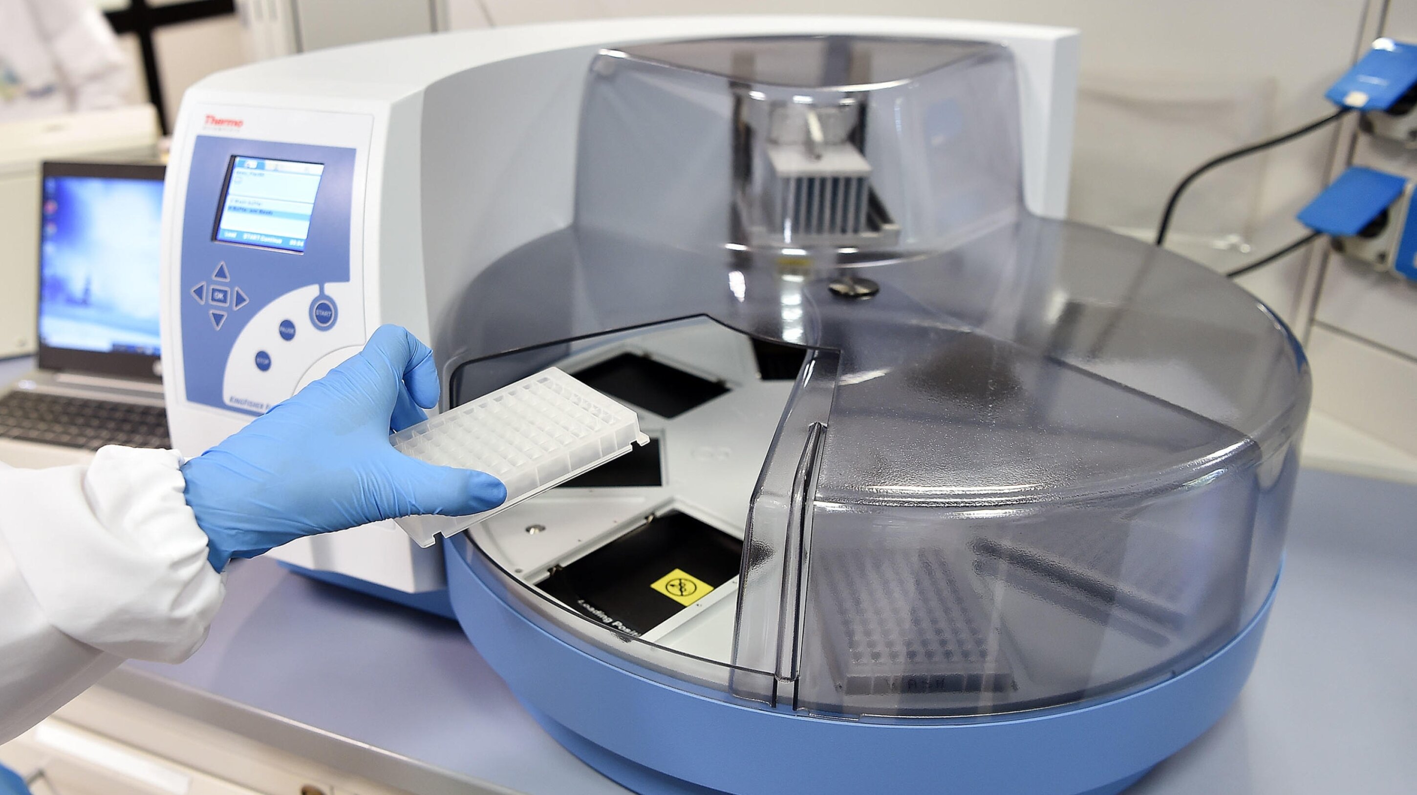 Febbre del Nilo: da maggio un caso in Sicilia