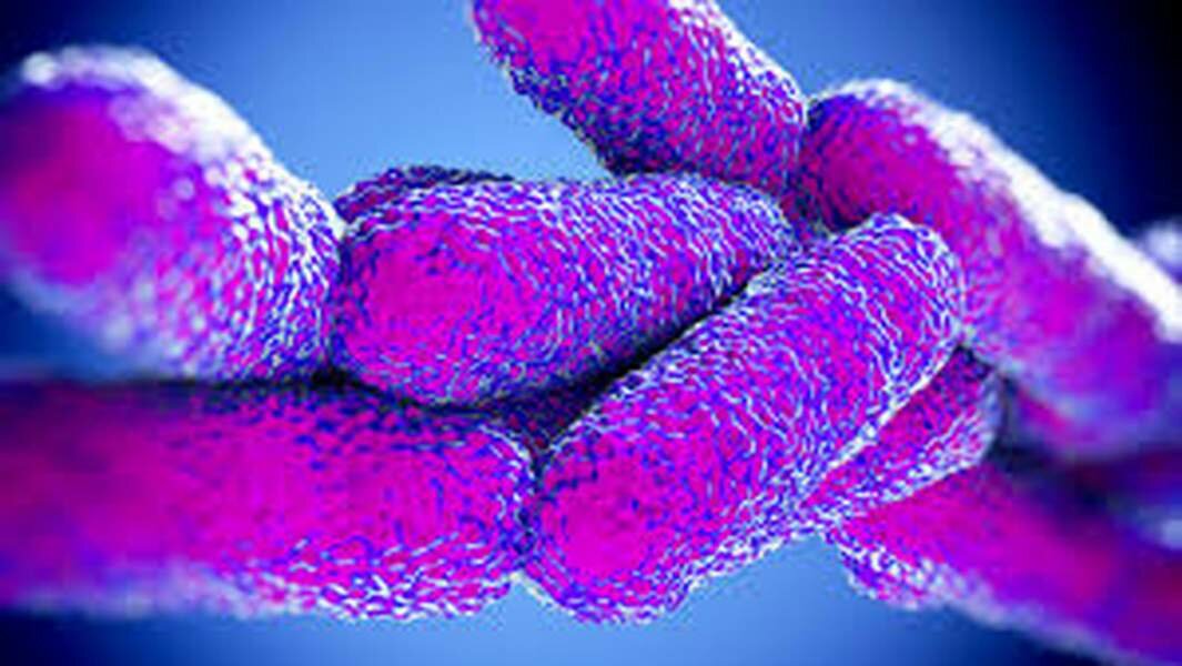 Sospetta legionella, chiusi due istituti alberghieri