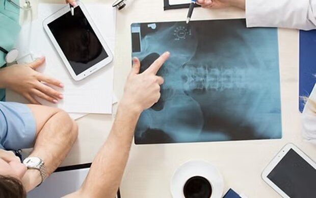 Consultazione medica su radiografia dell'anca con specialisti ortopedici