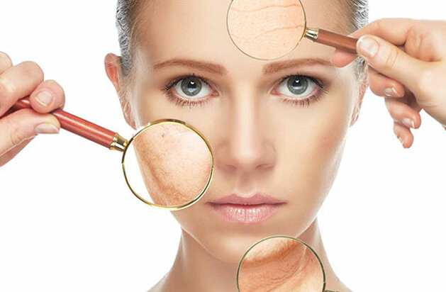 Filler Labbra Napoli