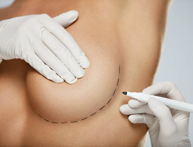 Mastoplastica Additiva Napoli