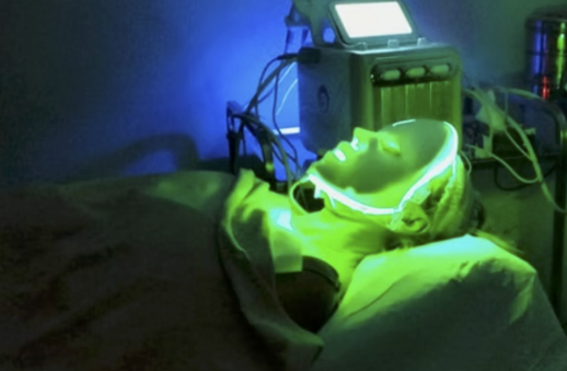 Radiofrequenza Viso Napoli