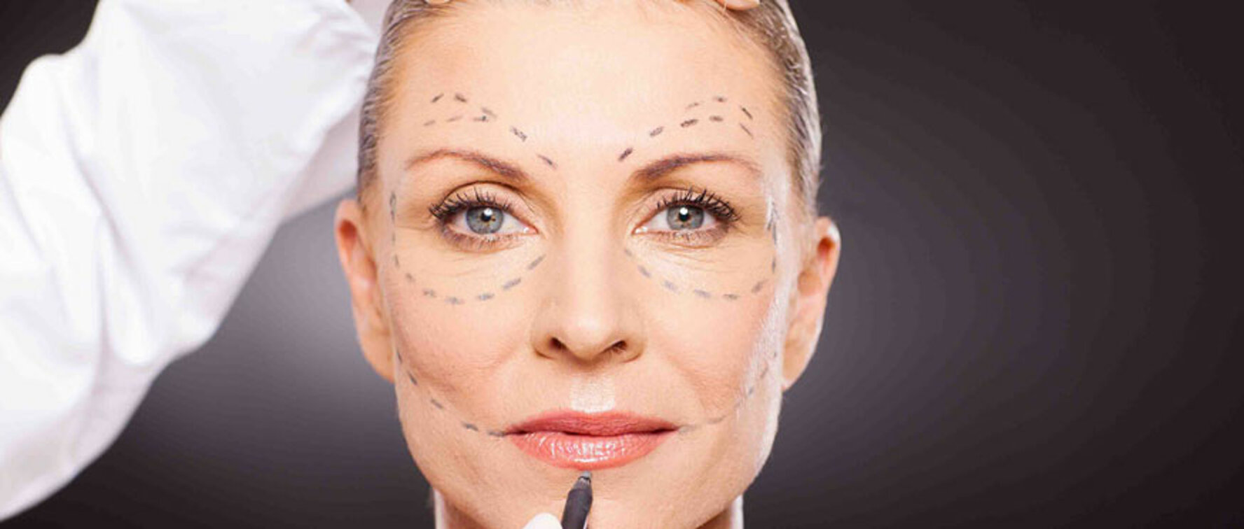 Chirurgia Plastica Napoli