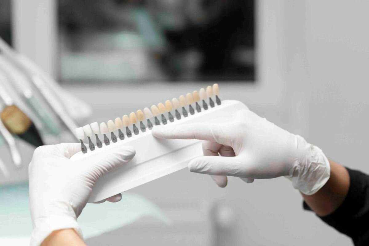 Faccette dentali a Pesaro: perché non bisogna avere paura di un sorriso poco naturale Faccette dentali a Pesaro: perché non bisogna avere paura di un sorriso poco naturale