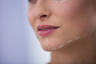 donna-con-segni-disegnati-per-il-trattamento-cosmetico-sulla-sua-mascella.jpeg donna-con-segni-disegnati-per-il-trattamento-cosmetico-sulla-sua-mascella.jpeg