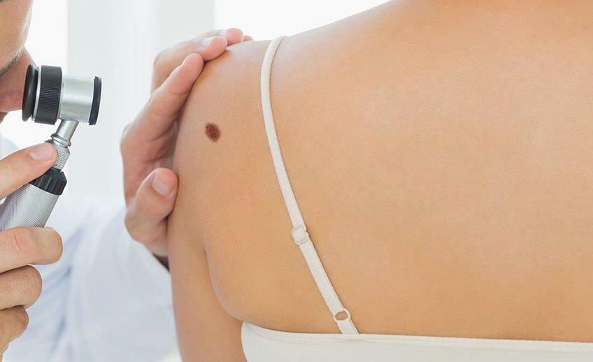 Skin Cancer: il melanoma fa meno paura. Dalla rivoluzione nelle terapie al rapporto tra dermatologia e arte