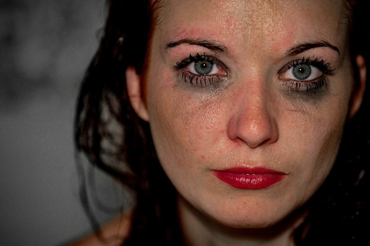 Quando la cistite non passa: gli errori frequenti che ostacolano la guarigione