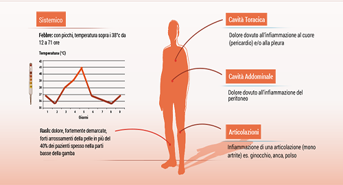Febbre Mediterranea Familiare, a Palermo e Catania i primi incontri per conoscere una patologia semisconosciuta