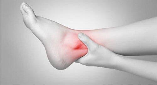 Ecco cosa fare in caso di contusione, problema piuttosto comune