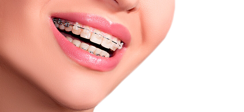 ortodonzia_slide_scuratti-dentaltrade_it.jpeg
