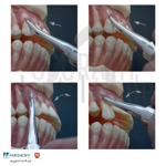 dental-luxator-maestrale-medesy-oral-surgery