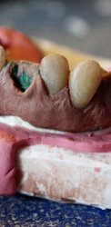 ICE SCREAM 2009Acrylic resin denture for a torture scene (check link at min 11:43)