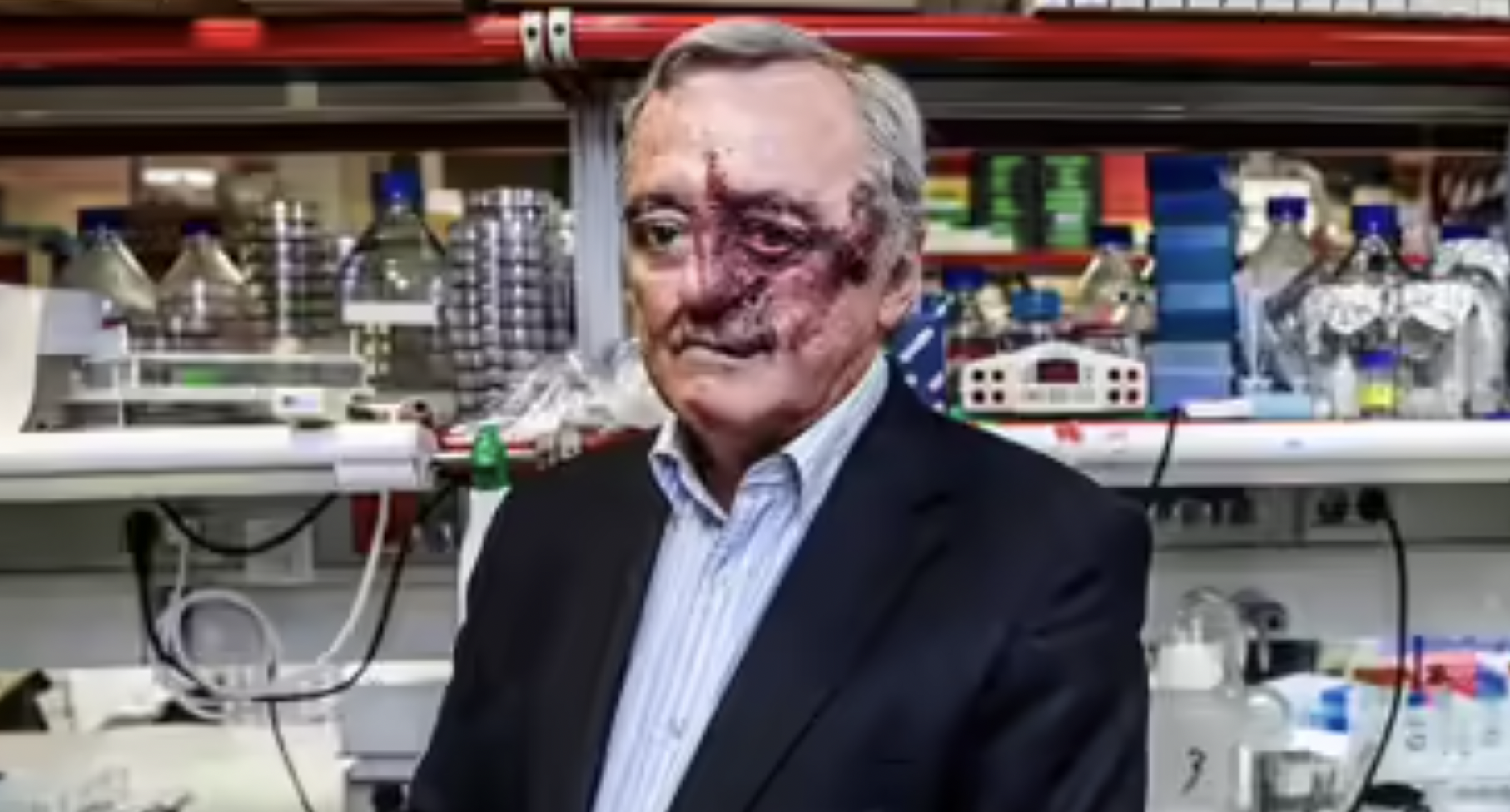 Tumore del pancreas, dalla Spagna una nuova speranza: una tripletta di farmaci elimina le cellule tumorali nei modelli animali