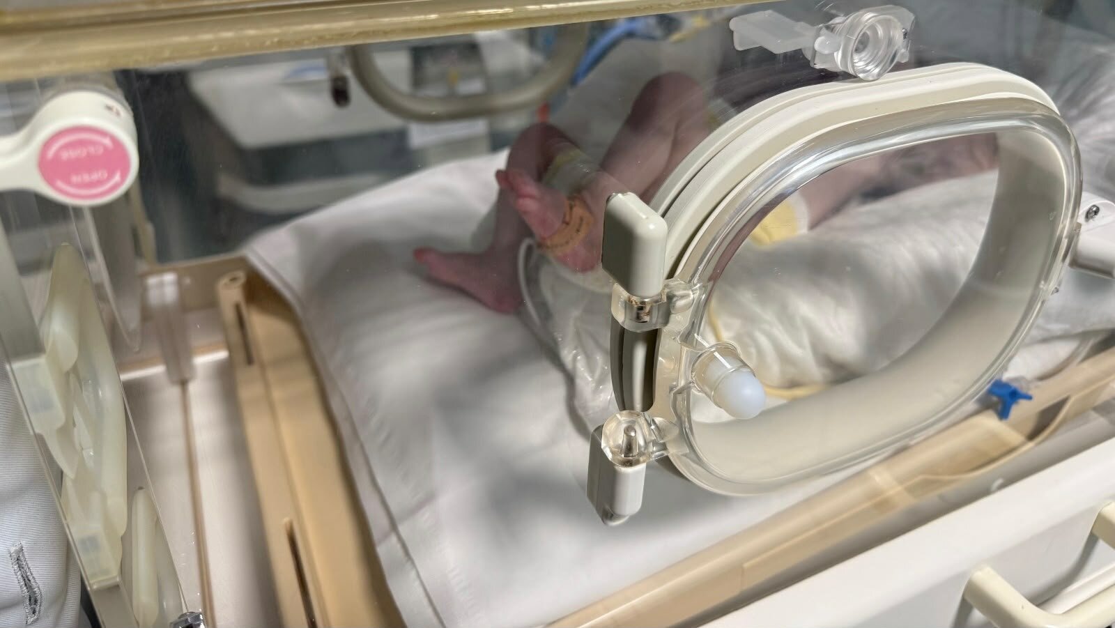 Atrofia muscolare spinale: al Policlinico di Catania al via screening per i neonati della Sicilia orientale