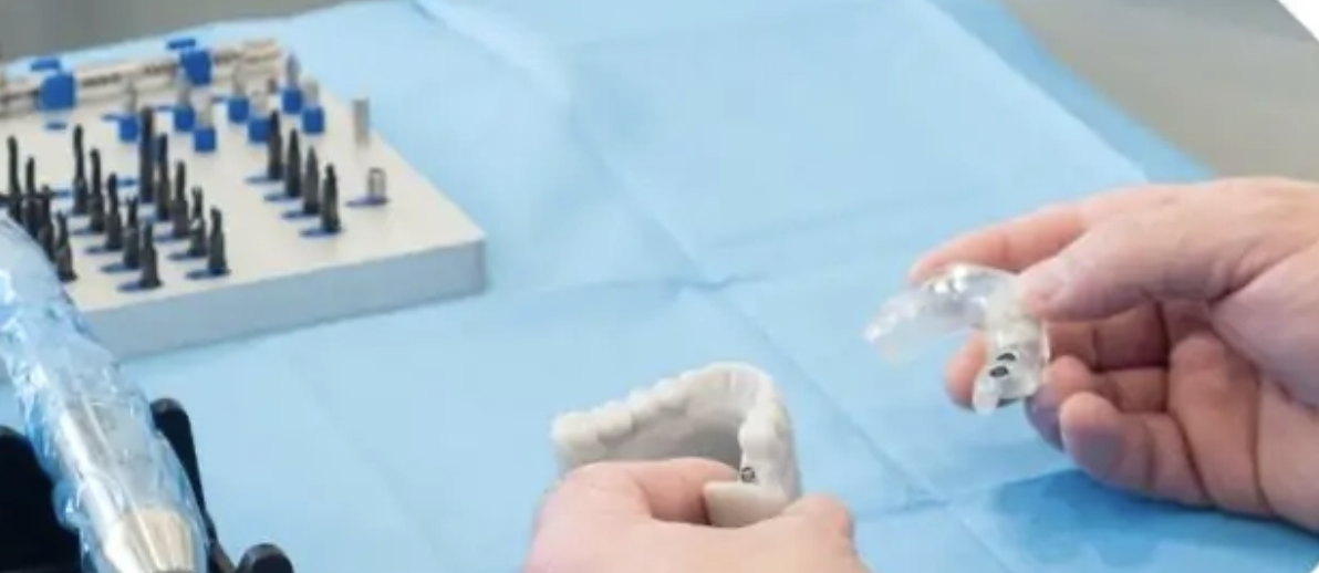 Implantologia dentale e seno mascellare: ad Acireale nasce un percorso multidisciplinare per gestire le complicanze in modo più sicuro
