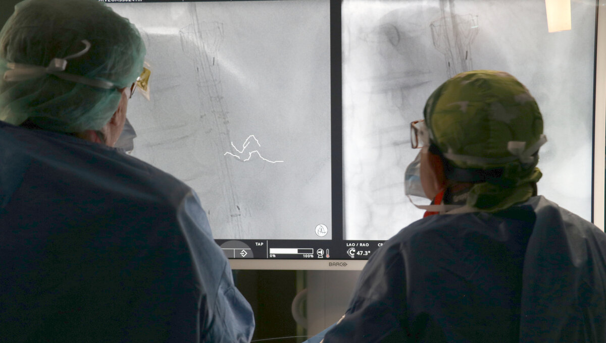 Dentro i vasi, in 3D, durante l’intervento