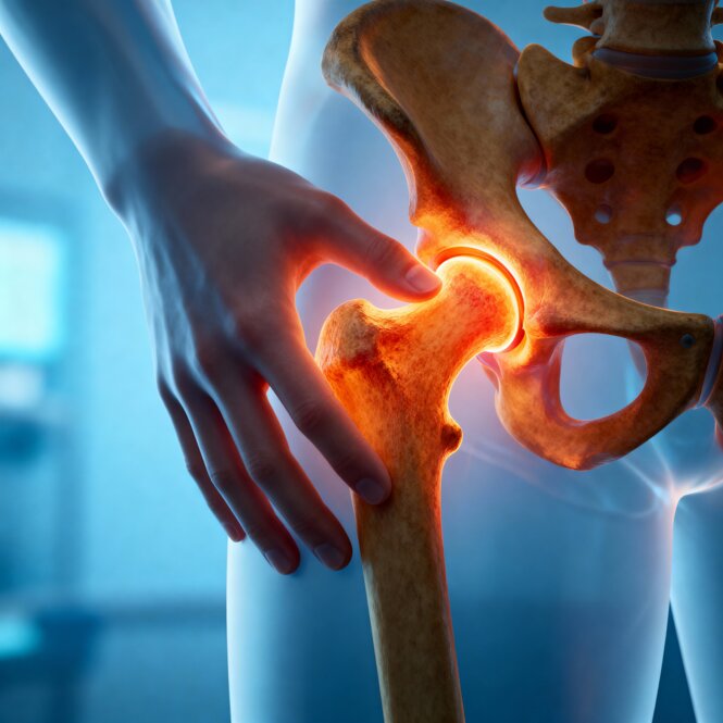 Ortopedico Anca Roma