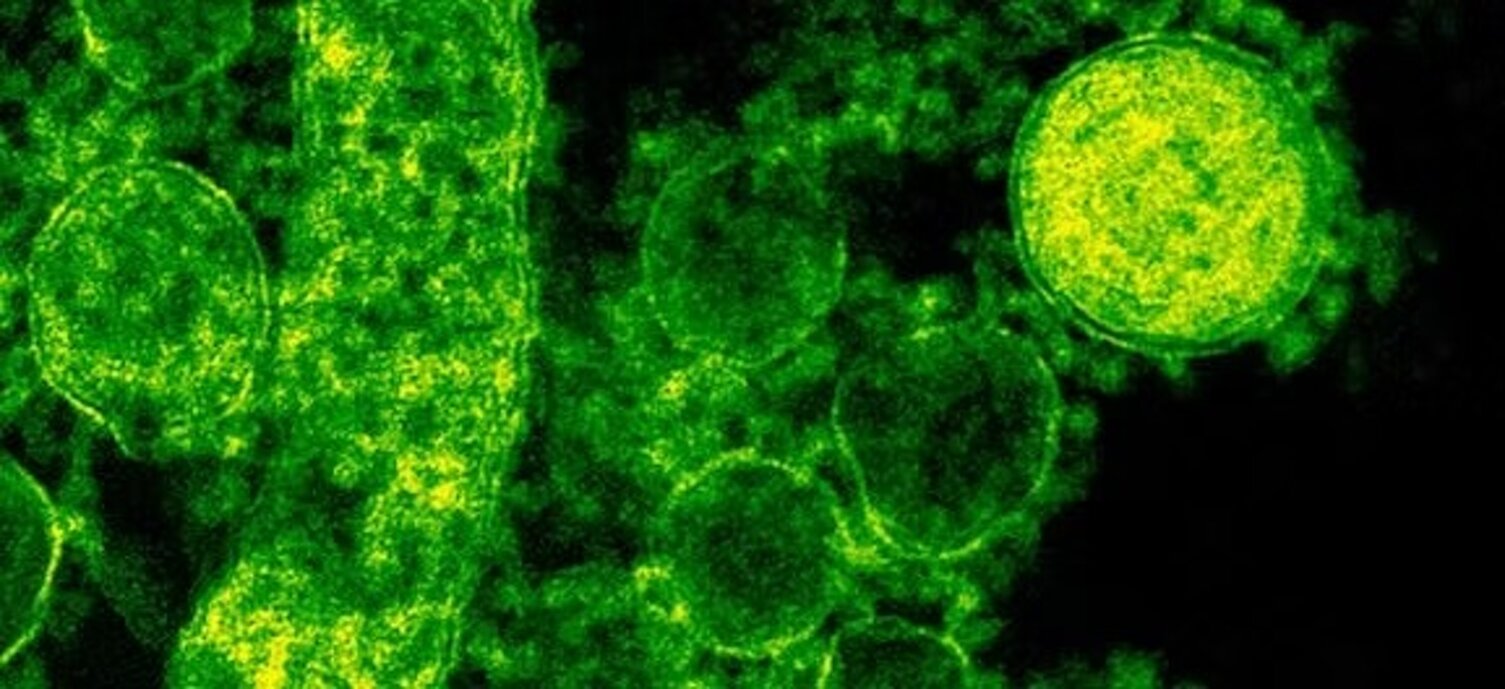 imgi_4_79aa6c_1ff36d85db2d47a8b694c85071ba4dbf~mv2.jpeg imgi_4_79aa6c_1ff36d85db2d47a8b694c85071ba4dbf~mv2.jpeg