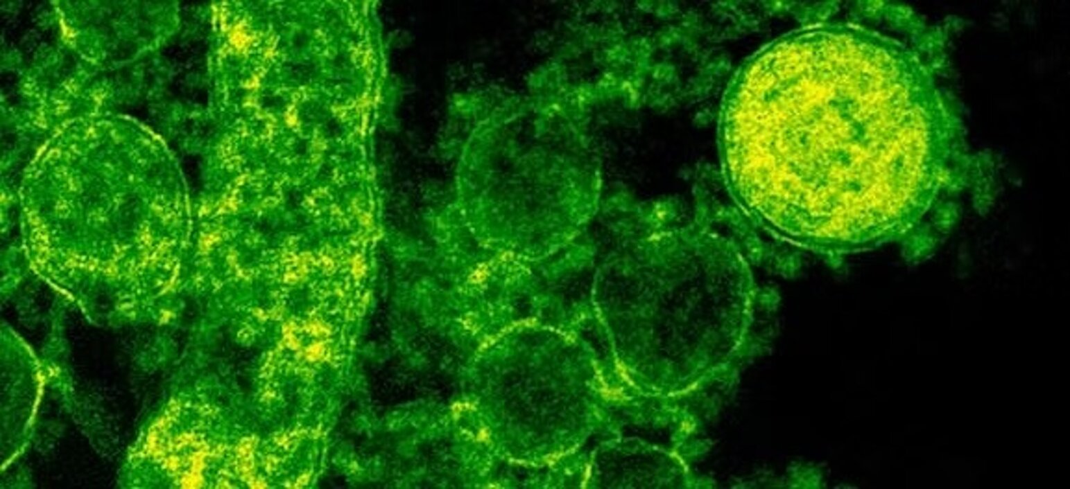 imgi_4_79aa6c_1ff36d85db2d47a8b694c85071ba4dbf~mv2.jpeg imgi_4_79aa6c_1ff36d85db2d47a8b694c85071ba4dbf~mv2.jpeg