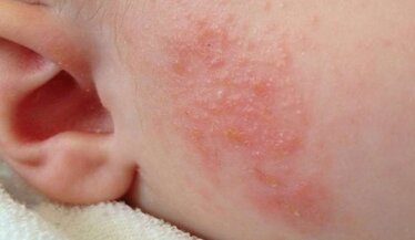 e87ca6c0b41b09787aa6c5aacedf0bb5d5810ee2