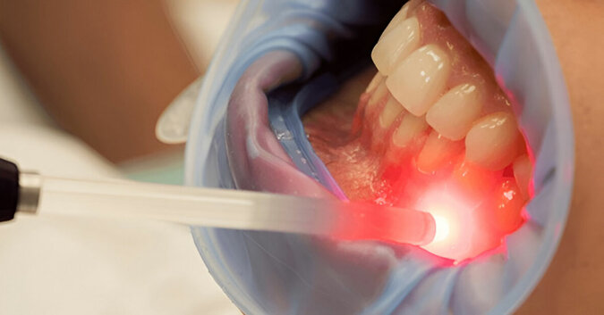 laser-treatment-1.jpeg