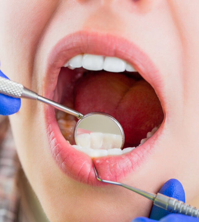 taking-care-teeth-woman-dentist-dental-care-taking-care-teeth-girl-having-teeth-examined-dentists-woman-stomatology-clinic-with-dentist-healthy-teeth-concept.jpeg