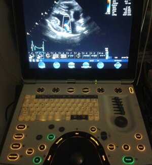 cane-holter-300x225.jpeg