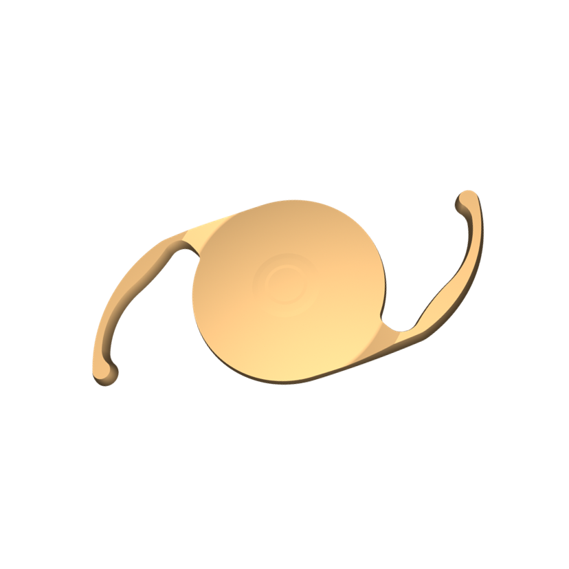 TIPOLOGIA DELLE LENTI INTRAOCULARI DOPO CHIRURGIA DELLA CATARATTA