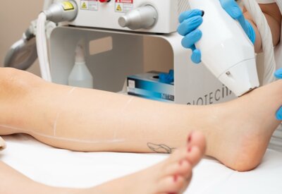 estetista esegue la depilazione laser con strumenti di estetica avanzata