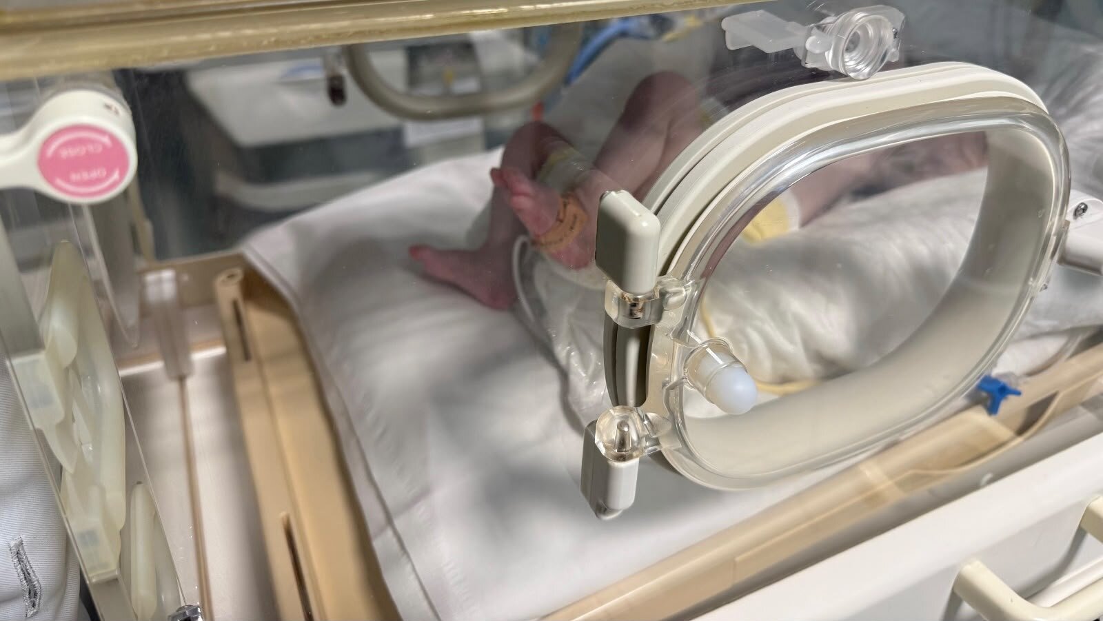 Su SudSalute Atrofia muscolare spinale: al Policlinico di Catania al via screening per i neonati della Sicilia orientale Su SudSalute Atrofia muscolare spinale: al Policlinico di Catania al via screening per i neonati della Sicilia orientale