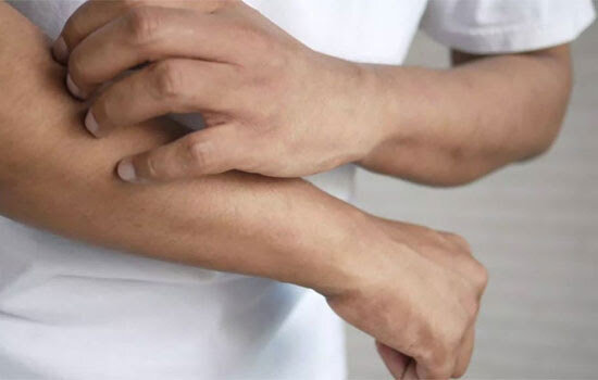Su SudSalute Dermatite atopica, Apiafco: 3 milioni di italiani colpiti