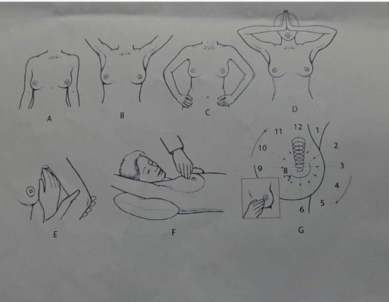Su SudSalute Catania, al Cibali ecografie mammarie gratuite per la prevenzione del tumore al seno Su SudSalute Catania, al Cibali ecografie mammarie gratuite per la prevenzione del tumore al seno