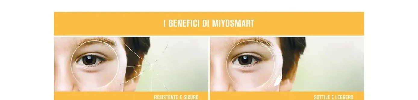 Miyosmart - Ottica Basile Miyosmart - Ottica Basile