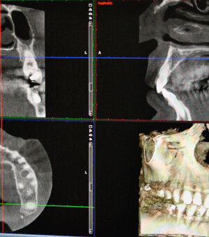 20171013-192734-e775384