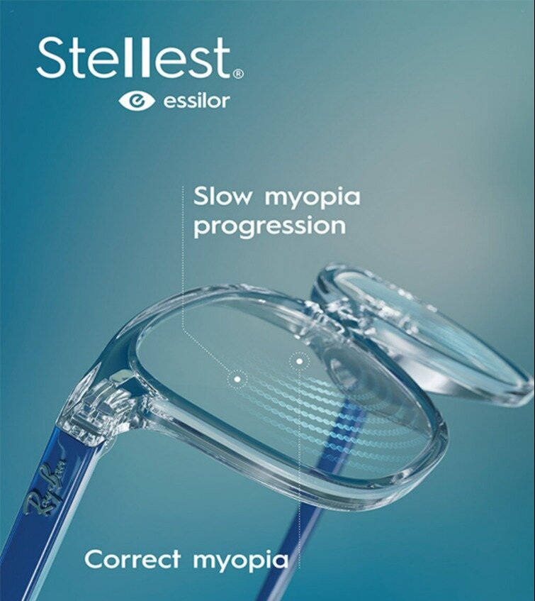 Lenti Stellest®: una soluzione innovativa per la gestione della miopia nei bambini.