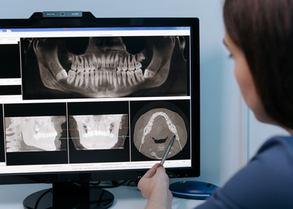 Pianificazione implantare digitale nello studio Polodent a Vazzola Treviso